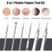 Blackhead Remover Tool 6 Piece Stainless Steel Black Head Revomer with Transparent Box Black Head Tool Remove for Blackheads Acne Milia and Other Skin Impurities - Buy Online on GoSupps.com