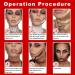 Mysense Liquid Latex SFX Makeup Halloween Moster Zombie Special Effects Makeup For Scar Cut Wound Peeling Skin Wrinkes Stipples Burns Blisters Light Flesh 1 OZ 30 Ml Light Flesh - Buy Online on GoSupps.com