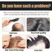 EXQST Spartan Shampoo - Spartan Root Revitalizing Shampoo Get Results in Just 6 Weeks - Buy Online on GoSupps.com
