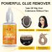 Lace Wig Glue Remover Tape Remover Hair Extensions & Tape Extensions Remover Fast Acting Wig Remover For Hair Glue Tape Hair Extension Remover Wig Tape&Hairpiece&Toupee Systems (Wig Glue Remover) - Buy Online on GoSupps.com