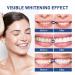 Teeth Whitening Paint 5ml - Oral Cleaning for Stains & Yellow Teeth - Whitens & Beautifies - One Size (White) - Buy Online on GoSupps.com