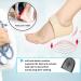 Heel Protectors Heel Cups (4PCS Beige) - Adjustable Breathable Support for Heel Pain, Plantar Fasciitis, Tendinitis, Heel Spur - Women's Heel Cushion for Aching Feet - Buy Online on GoSupps.com