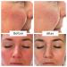 Buy LIFT LAB Lift Fix Calm Serum Reduce Redness & Inflammation 2 Fl Oz - International Shipping Available - Buy Online on GoSupps.com