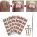 Ingrown Toenail Treatment Ingrown Toenail Corrector Ingrown Toenail Correction Patch Fixer Pedicure Toenail Correction Patch Sticker Foot Care Tool Ingrown Toenail Corrector Strips Foot Care Kit - Buy Online on GoSupps.com