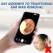 Wireless WiFi Ear Wax Removal Tool with 1296P FHD Camera - Smart Visual Earwax Remover for iPhone, iPad & Android - Buy Online on GoSupps.com