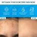 Acne Scar Buster (1x Light Up + 1x Clear It) - Buy Online on GoSupps.com