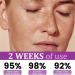  G n rique Face Lifting Solution 30ml Anti-Hyperpigmentation Skin Care Brightening Tightening Moisturizing Daily Repair Formula for Women and Ladies Beauty Enhancing Hydration - Buy Online on GoSupps.com