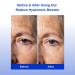 Michael Marcus Hyaluronic Booster PLUS - Anti-Aging Plant-Based Face Serum for Fine Lines & Wrinkles Intense Hydration & Radiance - 1oz Bottle - Buy Online on GoSupps.com