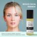 Azelaic Acid 10% Serum - Reduces Facial Redness | 3.4 fl. oz. (100ml) - Best Azelaic Acid Serum for Face | International Shipping Available - Buy Online on GoSupps.com