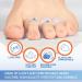 Kimihome 16-Pack Bunion Guards with Attached Toe Separator - Toe Straightener for Overlapping Toes - Relief from Big Toe Drifting - Gel Bunion Corrector with Triple Loops - Buy Online on GoSupps.com