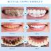 Whiteout Instant Teeth Whitening Paint - Instant Teeth Whitening (2 Pack) | Brighten Your Smile Quickly! - Buy Online on GoSupps.com