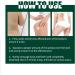 Cr me Nettoyante Acn Fesses et Cuisses Cr me pour les Boutons des Fesses Nettoyage Cr me Dissolvant de Boutons pour les Fesses 100ML 1PC - Buy Online on GoSupps.com