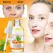 Turmeric Dark Spot Corrector Serum Turmeric Oil For Skin Wrinkles Facial Serum Natural Turmeric Face Serum for Skin Glow Dark Spot Corrector Serum Oil for Face & Body All Day Facial Moisturizer-30ml - Buy Online on GoSupps.com
