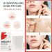 Original Hydrocolloid Acne Patches - 108 Count Spot Stickers for Zits & Blemishes | International Shipping - Buy Online on GoSupps.com