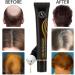 Organic Hair Serum Roller Set | Hair Growth Essence for Men & Women | Triple Roll-On Massager | 2 PCS Set - Buy Online on GoSupps.com