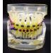 Dental Typodont Orthodontic Teeth Model with Metal Braces & Ligature Ties - Buy Online on GoSupps.com