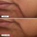 Perricone MD Essential Fx Acyl-Glutathione Rejuvenating Moisturizer 1 Fl Oz - Anti-Aging Skin Treatment - Buy Online on GoSupps.com