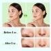 IETONE Stainless Steel Facial Pore Cleaner Scraper - Double-Head Blackhead Remover Sticks for Acne, Comedone, Blackhead, Whitehead - Metal Extractor Tools for Face Cleaning - Buy Online on GoSupps.com
