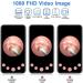 Ear Wax Removal Kit with 1080P HD Camera, 6 LED Lights, IP67 Waterproof - Wireless Ear Endoscope for iPhone, iPad & Android - Black - Buy Online on GoSupps.com
