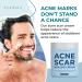 Acne Scar Healing Cream | Vitamin E Face Cream for Zit, Milia & Blemish Scarring | Skin Repair Treatment for Pimple Marks & Dark Spots | 200+ Treatments by Ayadara - Buy Online on GoSupps.com