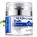 Scar Removal Cream Scar Repair Cream for Acne Scars Stretch Marks Surgical Scars Burns Old and New Scars Natural Formula Scar Cream for Face and Body Suitable for Most Skin Types