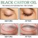 Obidodi Organic Castor Oil 60 ml 100% Pure Natural Castor Oil Organic Cold Pressed Castor Oil for Hair Growth Eyelashes Eyebrows - Vegan and Cruelty Free - Buy Online on GoSupps.com