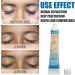 Dauerhaft Vitiligo Treatment Ointment - Herbal Extract Vitiligo Cream for Skin Pigmentation - 0.7oz - Buy Online on GoSupps.com