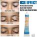 Herbal Face Vitiligo Cream for Skin Pigmentation Treatment - 0.7oz - Buy Online on GoSupps.com