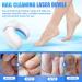 Buy Nail Fungus Laser Treatment Device - Rechargeable & Portable Cold Laser Therapy for Fingers & Toenails - Buy Online on GoSupps.com
