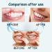 Spray Soulager les Gencives D garnies Spray de Soulagement des Gencives Spray Contre les Maux de Dents 30ML 1PC - Buy Online on GoSupps.com