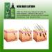 Hair Growth Serum & Lotion for Men & Women - Nourishing Hair Regrowth Treatment & Care - Buy Online on GoSupps.com