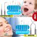 Professional Dental Hygiene Kit - Stainless Steel Teeth Cleaning Tools for Plaque and Tartar Removal, Oral Care Set with Scraper, Scaler, Pick - Includes Case - Buy Online on GoSupps.com