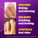 SILKA Anti-Fungal Cream 1 Oz - Clinical Foot Treatment Fluid - Buy Online on GoSupps.com
