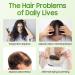 100% Pure Natural Rosemary Oil - Multipurpose Hair Oil for Growth Nourishing Scalp & Strengthening Hair - Buy Online on GoSupps.com