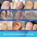 Extra Strength Toenail Fungus Treatment - 1% Tolnaftate for Discolored Nails & Athlete's Foot (30ml) - Fast-Acting OTC Formula - Buy Online on GoSupps.com