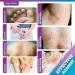 Cr me Antifongique Pied et Mycose Peau: Pityriasis Versicolor creme Soin Topique pour Pied Aine Aisselle et Plis Confort Protection et Hygi ne Quotidienne purple - Buy Online on GoSupps.com
