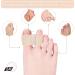 12 Pack Toe Spacers for Overlapping Toes - Toe Separators for Bunion and Hammertoe Straightening - Buy Online on GoSupps.com