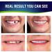 Natural Shade Fake Teeth Veneers for Upper & Lower Jaw - Ideal for Halloween, Christmas & Daily Wear - Buy Online on GoSupps.com