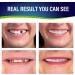 F ke T eth  4 Pcs Denture Teeth for Women and Men  Comfortable Dental Veneers for Upper and Lower Jaw  Realistic Natural Temporary Regain Confident Smile natural/teeth - Buy Online on GoSupps.com