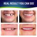 Comfortable Cosmetic Fake Teeth Set for Confident Smile - Natural Shade Veneers for Upper and Lower Jaw - Buy Online on GoSupps.com