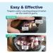 Vetnique Dentabliss - Dog Teeth Cleaning Finger Mitt Dental Wipe - Dog Plaque and Tartar Prevention with Brushing Beads - Convenient Dog Teeth Wipes with Peppermint Dog Breath Freshener 50ct - Buy Online on GoSupps.com