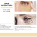 Retinol Eye Mask Retinol Under Eye Patches Anti Aging Eye Patches Eye Treatment Masks Moisturise Nourish Firm Eye Masks Reduce Puffiness Dark Circles and Smooth Wrinkle (2PC) - Buy Online on GoSupps.com