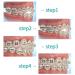 LVCHEN Penguin Rubber Bands for Braces - 500pcs 3.5oz Heavy Traction Bands - 5/16 inch (100pcs/pack) - Buy Online on GoSupps.com