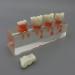 Dental Teeth Model for Endodontic Treatment - 4-Stage Teaching Aid for Studying Internationally - Buy Online on GoSupps.com