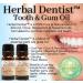 2 Pack Extra Strong Herbal Dentist Manicure - Fresh Breath Healthy Gums & Whiter Teeth - International Shipping Available - Buy Online on GoSupps.com