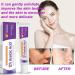 Azelaic Acid 12% Facial Serum Azelaic Acid Serum Face Cream Skin Care Beauty with Niacinamide & Vitamin C Removes Acne Redness Fade Dark Spots Correcting 20G (1) - Buy Online on GoSupps.com