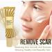 Yuemei Scar Vanishing Cream - Strengthen Skin Repair, Remove Old Scars & Stretch Marks | Suitable for All Skin Types - Buy Online on GoSupps.com