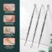 FVION Blackhead and Acne Extractor Kit - Professional 6 PCS Pimple Popper Tool Set for Face - Acne Tweezers and Blackhead Remover Tools - Buy Online on GoSupps.com