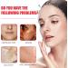 Aobenz Spot Remover for Face Anti Spot Serum Dark Spot Correcting Serum Sun Spot Dark Spot Remover Age Spot Treatment Face Serum Skin Whitening Spot and Freckle Remover Spot Treatment for Face 50ml - Buy Online on GoSupps.com