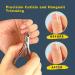 AVXIGO FIELD Professional Cuticle Nipper - Built-in Compression Coil Spring Precise Sharp Straight Blade Full Jaw Surgical Grade Stainless Steel Premium Cuticle Trimmer - Microfiber Cloth Included - Buy Online on GoSupps.com